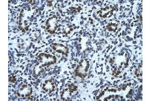Rabbit Anti-HMGN1 Antibody       Paraffin Embedded Tissue:  Human alveolar cell   Cellular Data:  Epithelial cells of renal tubule  Antibody Concentration:   4.
