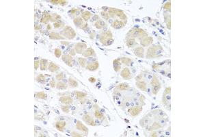 Immunohistochemistry of paraffin-embedded human stomach using MSMB antibody (ABIN6003799) at dilution of 1/100 (40x lens). (MSMB anticorps)