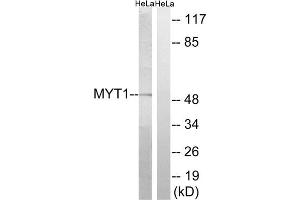 Western blot analysis of extracts from HeLa cells, using MYT1 (epitope around residue 83) antibody. (MYT1 anticorps  (Ser83))