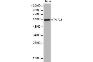 Western Blotting (WB) image for anti-Plasminogen Activator, Urokinase (PLAU) (AA 20-180) antibody (ABIN6219409) (PLAU anticorps  (AA 20-180))