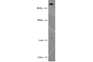 Western Blotting (WB) image for anti-Xin Actin-Binding Repeat Containing 2 (XIRP2) antibody (ABIN2906145) (XIRP2 anticorps)