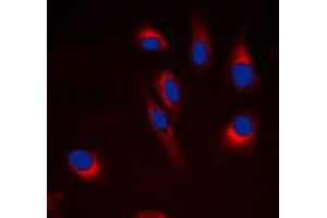 Immunofluorescent analysis of Cytochrome P450 21A2 staining in Hela cells.