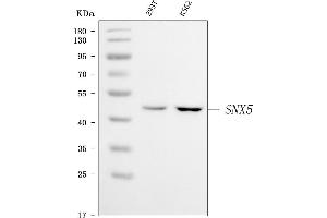 Western blot analysis of SNX5 using anti-SNX5 antibody (ABIN7601910).