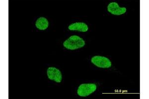 Immunofluorescence of monoclonal antibody to ATF2 on HeLa cell.