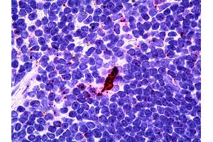 Anti-EBI3 antibody IHC of human lymphoid-dendritic cells. (EBI3 anticorps)