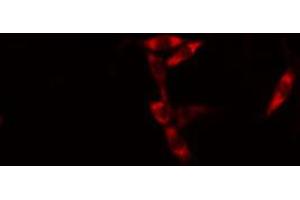 ABIN6274586 staining HuvEc cells by IF/ICC. (AIM2 anticorps  (Internal Region))