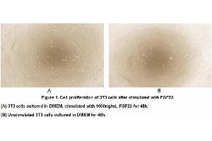 Image no. 2 for Fibroblast Growth Factor 23 (FGF23) (AA 25-251) (Active) protein (His tag) (ABIN6239859)