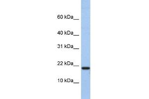 WB Suggested Anti-C1D Antibody Titration:  0. (C1D anticorps  (N-Term))