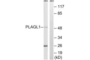 Western blot analysis of extracts from 293 cells, using PLAGL1 antibody. (PLAGL1 anticorps  (Internal Region))