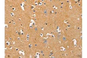 The image on the left is immunohistochemistry of paraffin-embedded Human brain tissue using ABIN7129239(DNM3 Antibody) at dilution 1/20, on the right is treated with fusion protein.