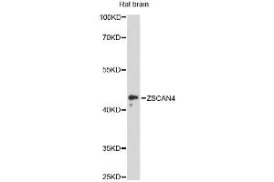 Western blot analysis of extracts of rat brain, using ZSCAN4 antibody (ABIN6293838) at 1:3000 dilution. (ZSCAN4 anticorps)