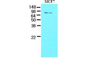 Western Blotting (WB) image for anti-Tyrosyl-DNA Phosphodiesterase 1 (TDP1) (AA 1-298), (N-Term) antibody (ABIN400858) (TDP1 anticorps  (N-Term))