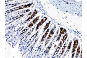 IHC analysis of CD166/ALCAM using anti- CD166/ALCAM antibody .