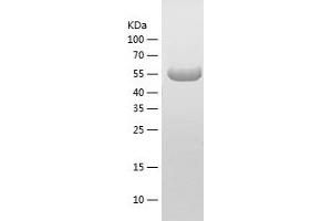 Western Blotting (WB) image for Stress-Induced-phosphoprotein 1 (STIP1) (AA 1-543) protein (His-IF2DI Tag) (ABIN7125219)