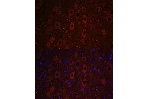 Immunofluorescence analysis of mouse brain using RUSC1 antibody (ABIN7270114) at dilution of 1:100. (RUSC1 anticorps  (AA 1-320))