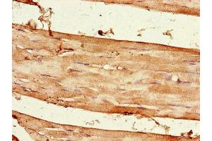 Immunohistochemistry of paraffin-embedded human skeletal muscle tissue using ABIN7167652 at dilution of 1:100 (Raptor anticorps  (AA 13-128))