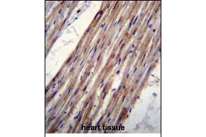 KCNJ8 Antibody (N-term) (ABIN656236 and ABIN2845552) immunohistochemistry analysis in formalin fixed and paraffin embedded human heart tissue followed by peroxidase conjugation of the secondary antibody and DAB staining. (KCNJ8 anticorps  (N-Term))