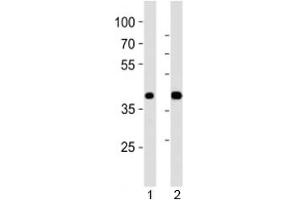 Western blot analysis of lysate from 1) mouse pancreas and 2) rat pancreas tissue using PDX1 antibody at 1:1000. (PDX1 anticorps  (N-Term))