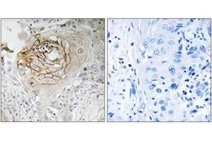 Immunohistochemistry (IHC) image for anti-Sodium Channel, Voltage-Gated, Type IX, alpha Subunit (SCN9A) (AA 651-700) antibody (ABIN2890640) (SCN9A anticorps  (AA 651-700))