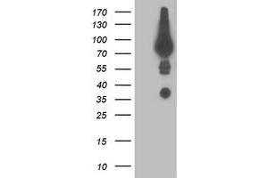 Western Blotting (WB) image for anti-Dipeptidyl-Peptidase 3 (DPP3) antibody (ABIN1497832) (DPP3 anticorps)