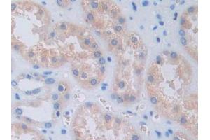Detection of GHRH in Human Kidney Tissue using Monoclonal Antibody to Growth Hormone Releasing Hormone (GHRH)