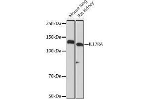 Western blot analysis of extracts of various cell lines, using IL17RA Rabbit mAb (ABIN7267989) at 1:1000 dilution. (IL17RA anticorps)