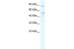 WB Suggested Anti-CHRNB2 Antibody Titration:  5. (CHRNB2 anticorps  (Middle Region))