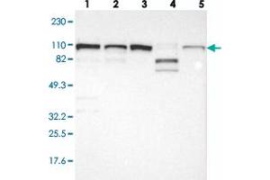 Western blot analysis of Lane 1: RT-4, Lane 2: U-251 MG, Lane 3: A-431, Lane 4: Liver, Lane 5: Tonsil with CTAGE5 polyclonal antibody . (MIA2 anticorps)