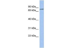 WB Suggested Anti-ZNF195 Antibody Titration:  0. (ZNF195 anticorps  (N-Term))