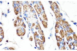 Immunohistochemistry of paraffin-embedded Human stomach using RNF149 Polyclonal Antibody at dilution of 1:100 (40x lens). (RNF149 anticorps)