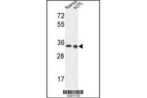 Western blot analysis in Ramos,A375 cell line lysates (35ug/lane). (Lactate Dehydrogenase A anticorps  (AA 154-182))