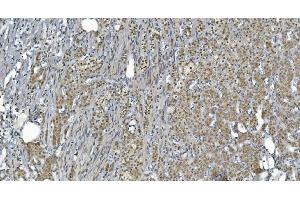 IHC analysis of GRX2/GLRX2 using anti-GRX2/GLRX2 antibody (ABIN7599022). (Glutaredoxin 2 anticorps  (AA 1-164))