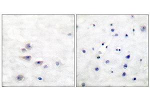 Immunohistochemistry (IHC) image for anti-SHC (Src Homology 2 Domain Containing) Transforming Protein 1 (SHC1) (pTyr427) antibody (ABIN1847217) (SHC1 anticorps  (pTyr427))