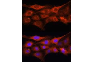 Immunofluorescence analysis of C6 cells using GALNS Rabbit pAb (ABIN6131691, ABIN6140937, ABIN6140938 and ABIN6221120) at dilution of 1:100 (40x lens).