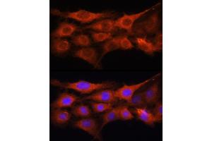 Immunofluorescence analysis of C6 cells using GALNS Rabbit pAb (ABIN6131691, ABIN6140937, ABIN6140938 and ABIN6221120) at dilution of 1:100 (40x lens). (GALNS anticorps  (AA 353-522))