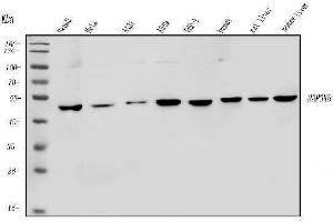 Western blot analysis of MAP3K8 using anti-MAP3K8 antibody (ABIN4886663). (MAP3K8 anticorps  (AA 9-193))