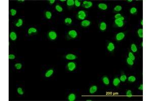 Immunofluorescence of monoclonal antibody to YY1 on HeLa cell. (YY1 anticorps  (AA 221-320))