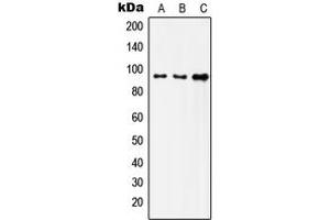 Western blot analysis of Insulin Receptor expression in HeLa (A), SKOV3 (B), HepG2 (C) whole cell lysates. (Insulin Receptor anticorps  (C-Term))