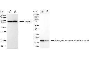 Western blotting analysis using eukaryotic translation initiation factor 5A antibody (ABIN7798534). (Recombinant EIF5A anticorps)