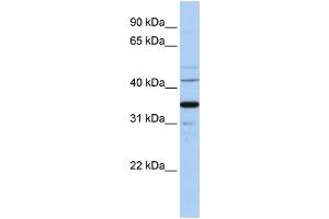 WB Suggested Anti-WNT5A Antibody Titration:  1 ug/ml  Positive Control:  Hela cell lysate WNT5A is strongly supported by BioGPS gene expression data to be expressed in Human HeLa cells (WNT5A anticorps  (Middle Region))