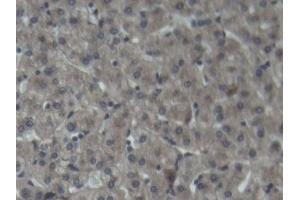 Detection of C3 in Porcine Liver Tissue using Polyclonal Antibody to Complement Component 3 (C3) (C3 anticorps  (AA 23-300))