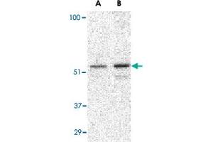 Western blot analysis of PLIN3 in Daudi cell lysate with PLIN3 polyclonal antibody  at (A) 0. (PLIN3 anticorps  (C-Term))