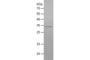 Western Blotting (WB) image for Hepcidin Antimicrobial Peptide (HAMP) (AA 24-84) protein (His-IF2DI Tag) (ABIN7123312)