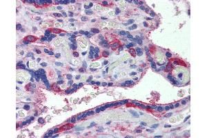 Anti-MARCH8 antibody IHC of human placenta. (MARCH8 anticorps  (C-Term))