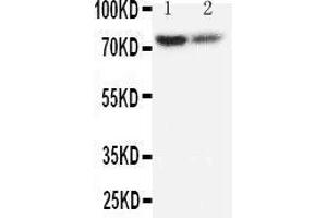 Anti-PMP70 antibody, Western blotting Lane 1: Rat Lung Tissue Lysate Lane 2: Rat Ovary Tissue Lysate (CX3CL1 anticorps  (C-Term))