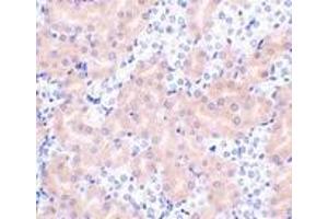 Immunohistochemistry of Bfl-1 in mouse kidney tissue with Bfl-1 antibody at 2 μg/ml.