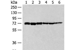 Western blot analysis of 293T cell Human fetal brain tissue Jurkat cell Hela cell Mouse heart tissue lysates using TCF25 Polyclonal Antibody at dilution of 1:250 (TCF25 anticorps)