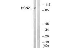 Western blot analysis of extracts from Jurkat cells, using HCN2 Antibody.