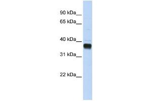 Western Blotting (WB) image for anti-Nudix (Nucleoside Diphosphate Linked Moiety X)-Type Motif 18 (NUDT18) antibody (ABIN2459244) (NUDT18 anticorps)