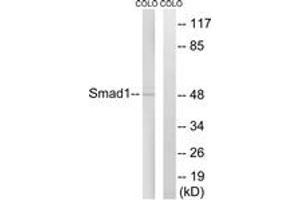 Western blot analysis of extracts from COLO cells, treated with EGF 200ng/ml 30', using Smad1 (Ab-465) Antibody.